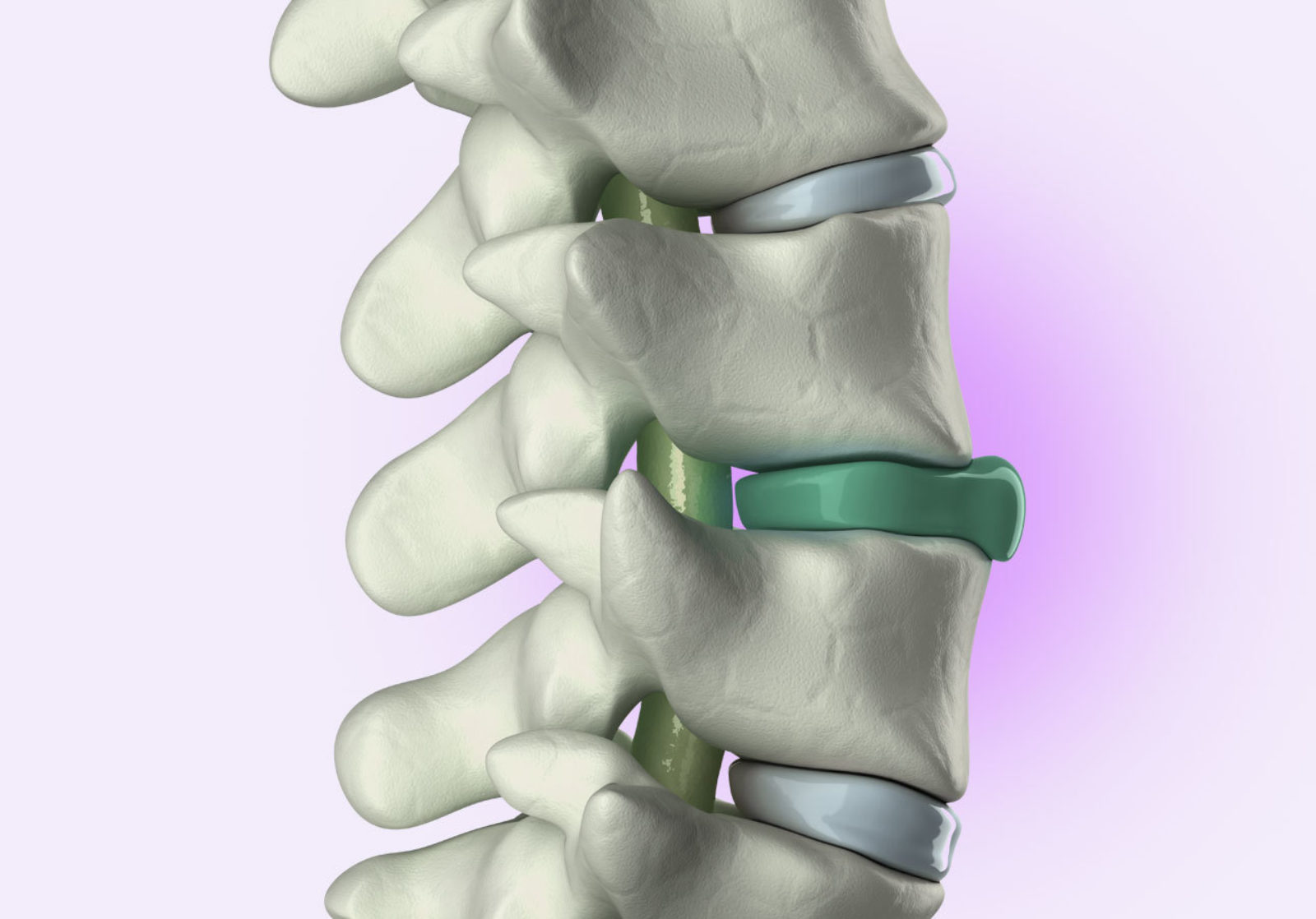Bild von Bandscheibenproblem: Warum ist die Matratze wichtig?