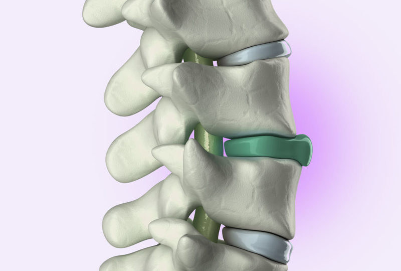 Die orthpädische Matratze